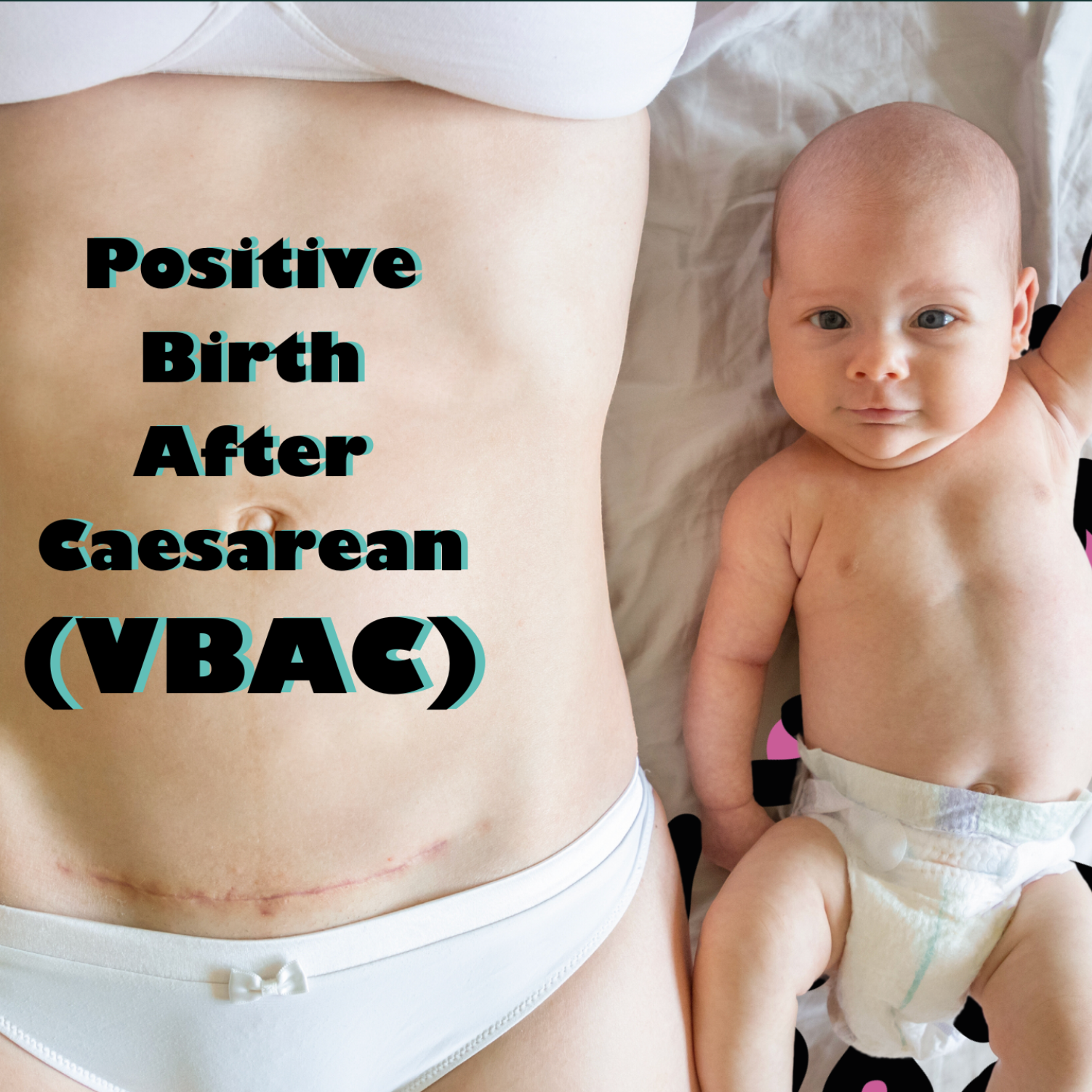 The Birth After Caesarean Pack (VBAC & RCAC)